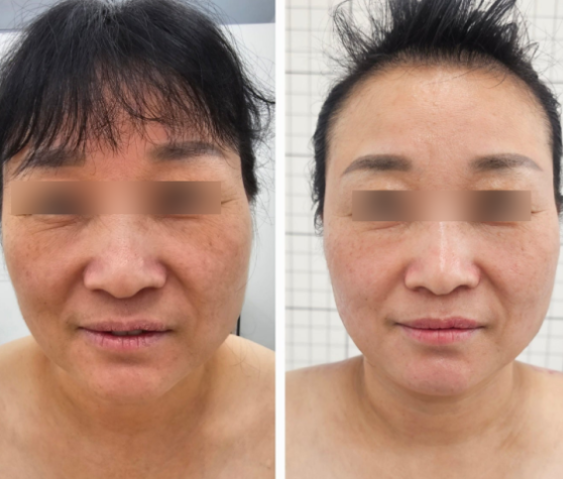 미미체형관리 이미지