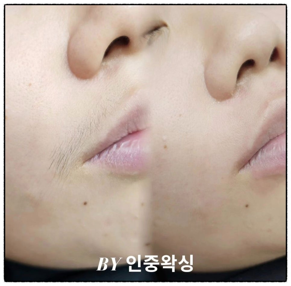뷰티;이곳 이미지