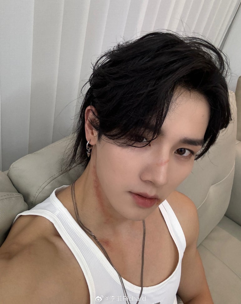 이비 이미지