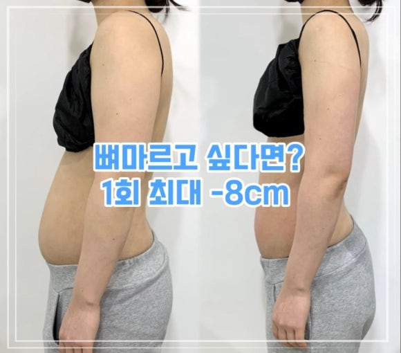 셀핏 이미지