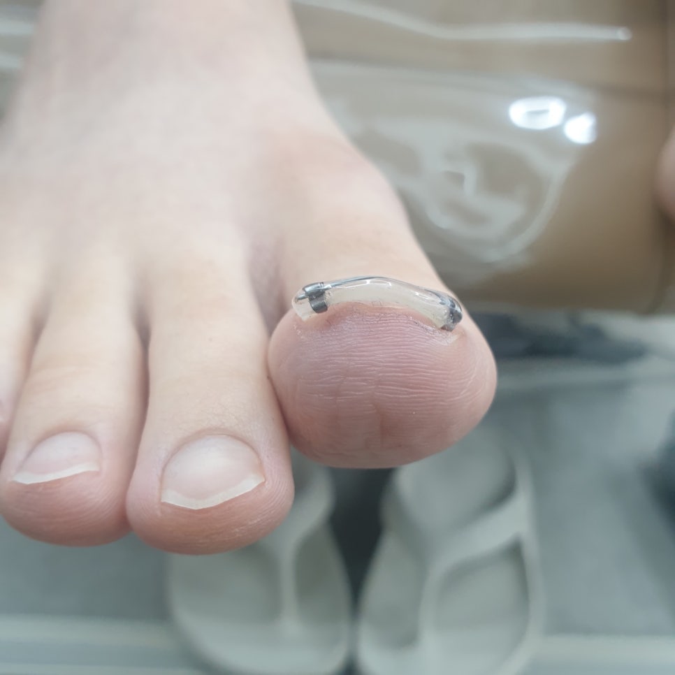 발라발라네일 이미지