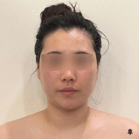 피부,빛나리 이미지