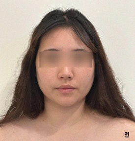 피부,빛나리 이미지