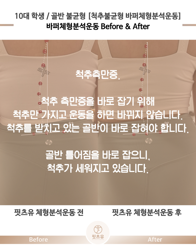 심한 비탈길 이미지