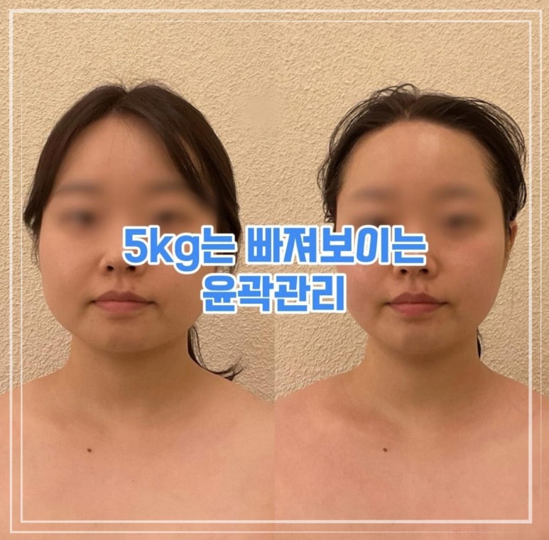 셀핏 이미지