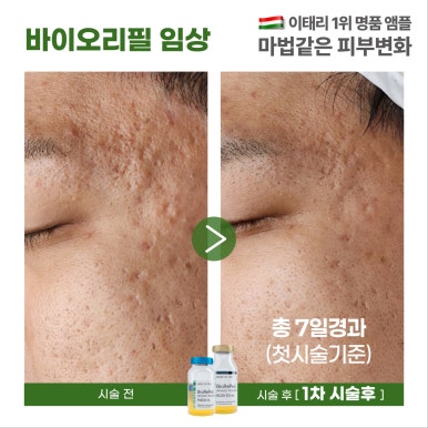 허니뷰티 이미지