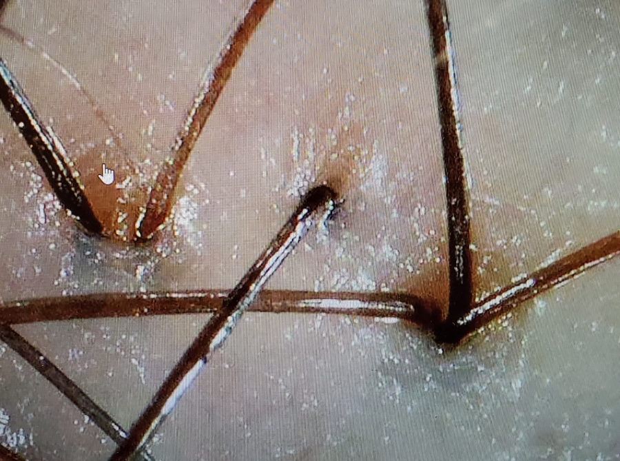 숲칼프가산두피탈모전문센터 이미지