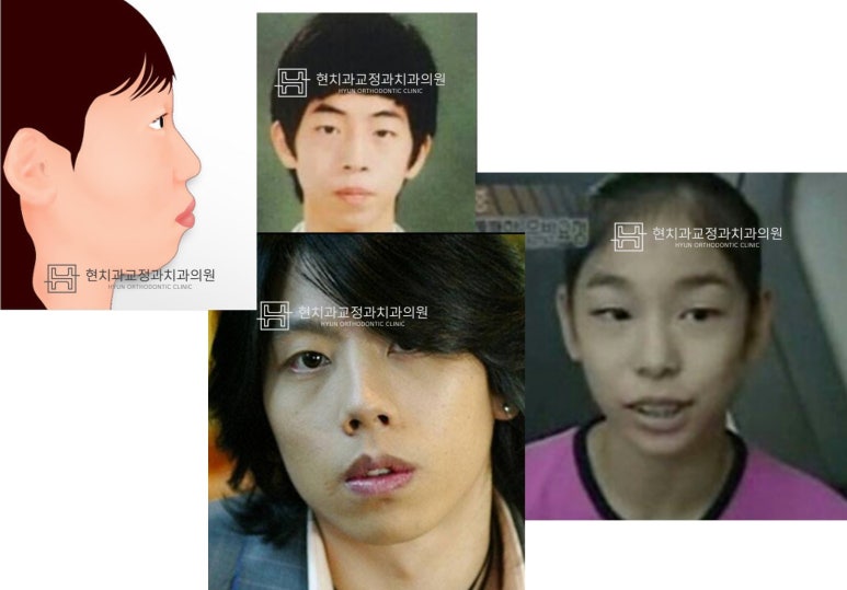 현치과교정과치과의원 이미지