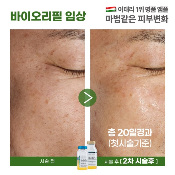 허니뷰티 이미지