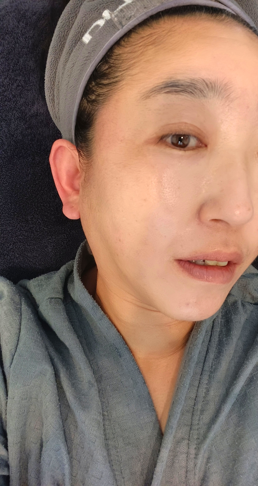 윤피부토탈관리 이미지
