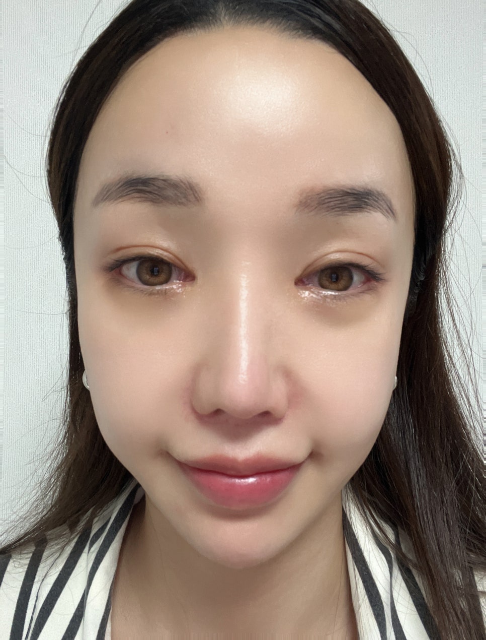 뷰티라인성형외과의원 이미지