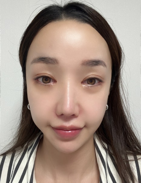 뷰티라인성형외과의원 이미지