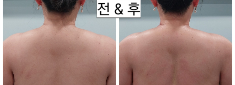 바른선 테라피 이미지