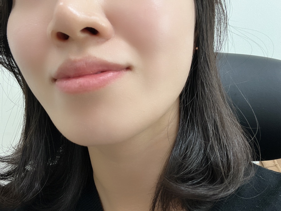 애플바디힐링 이미지
