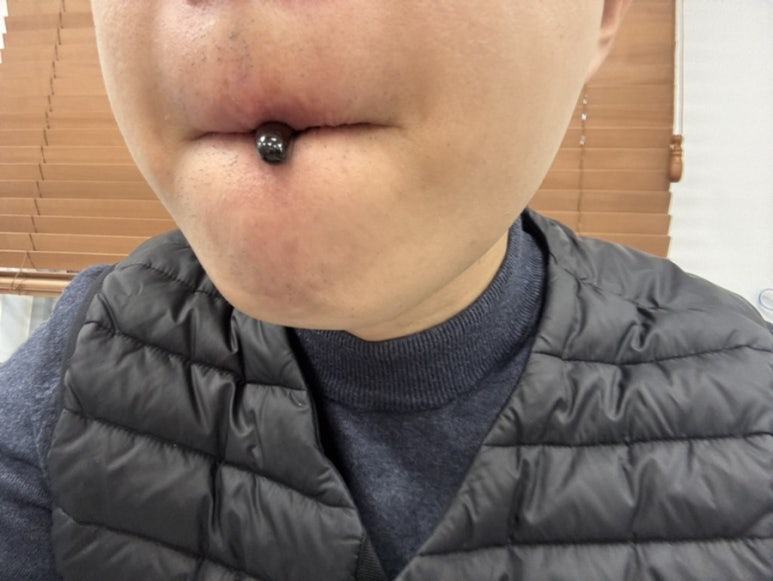 닥터유로포뮬라 이미지