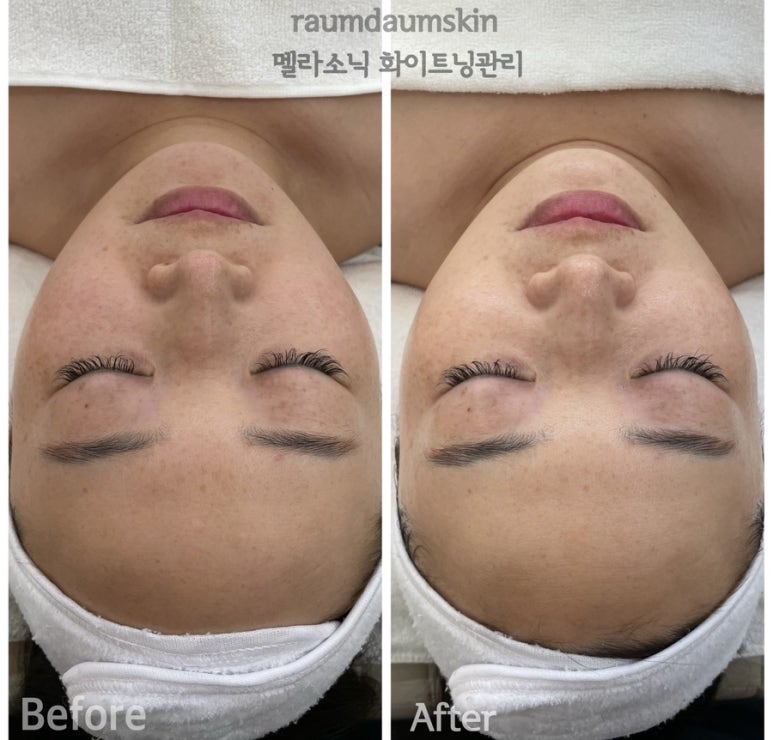 다움스킨 이미지