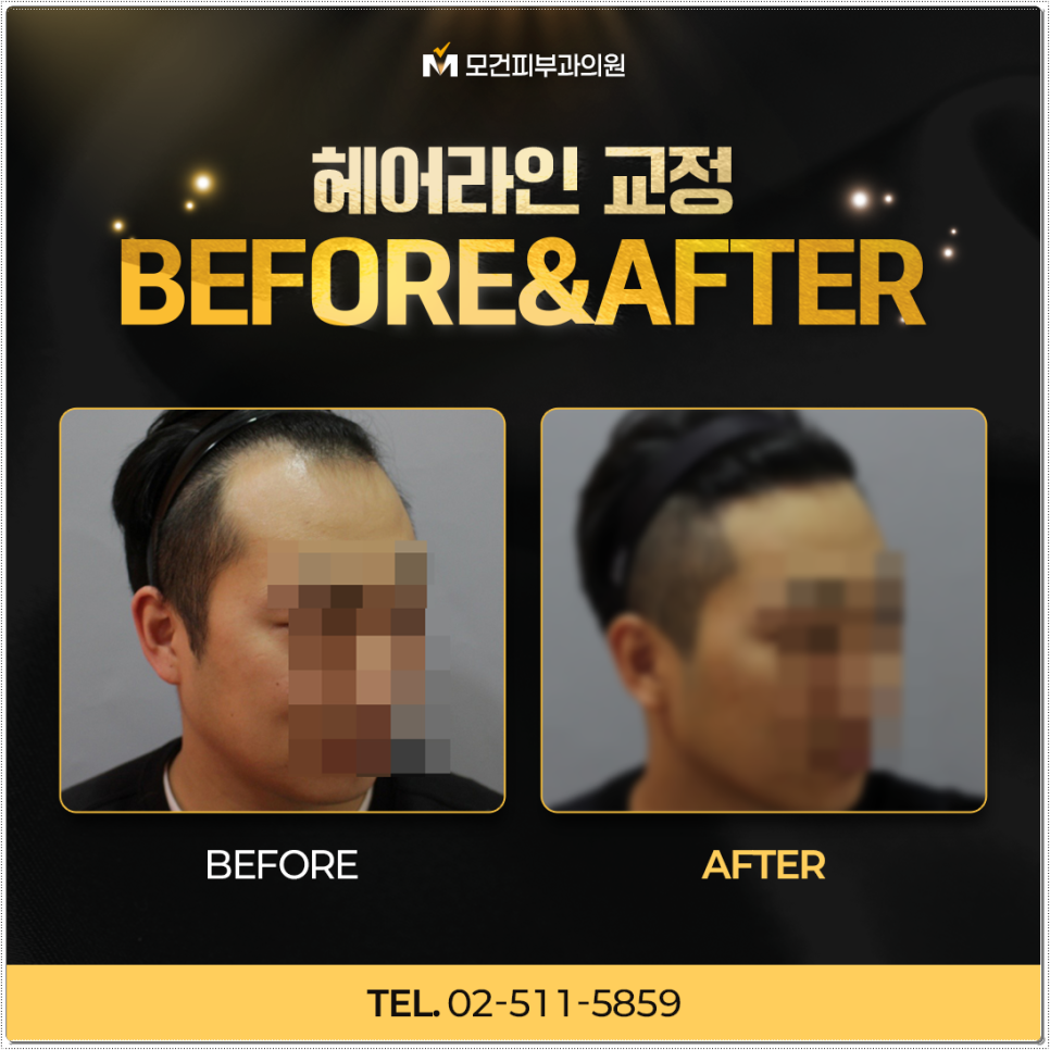 압구정헤어 이미지
