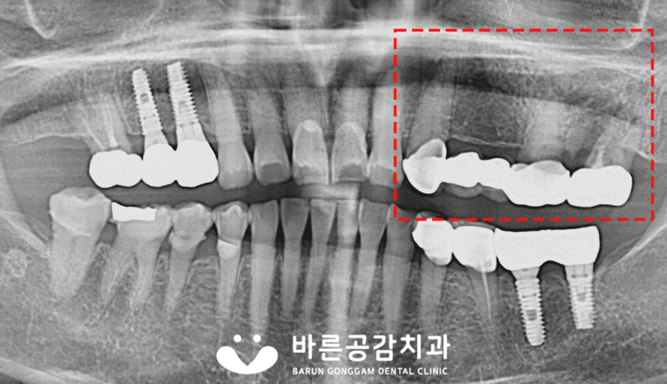 바른공감치과의원 이미지