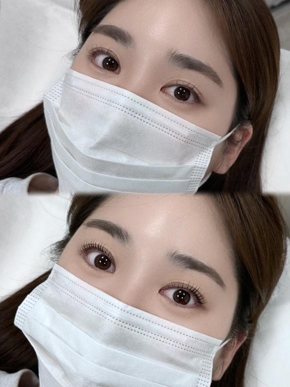 쏘뇨 이미지