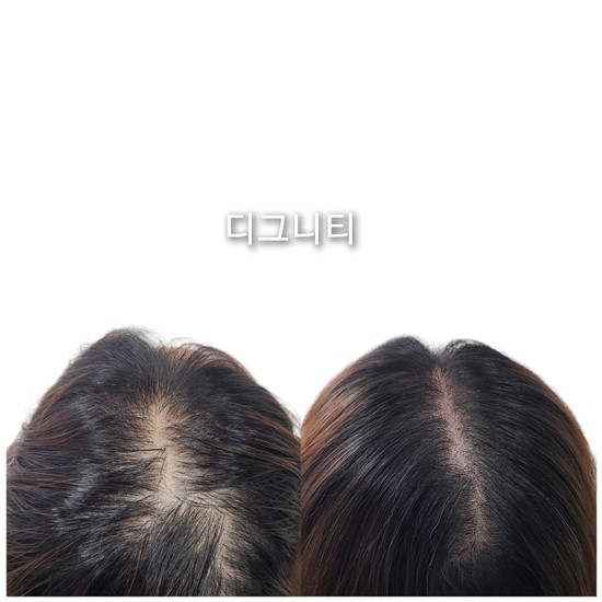토끼눈썹 이미지
