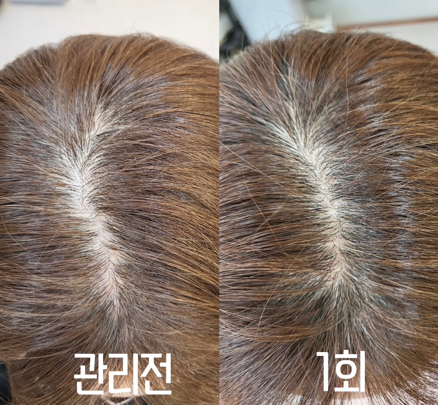 베네핏 에스테틱 이미지