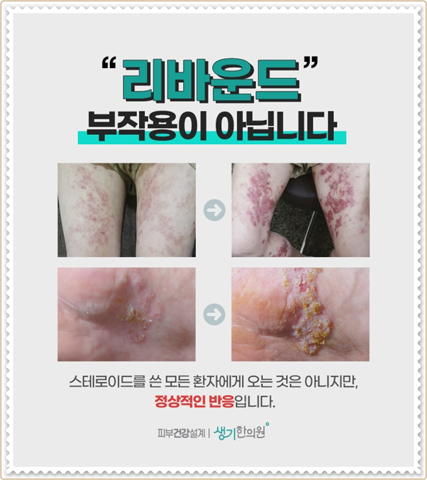 건강코다리 이미지