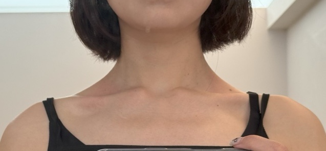 스톤베니어 이미지