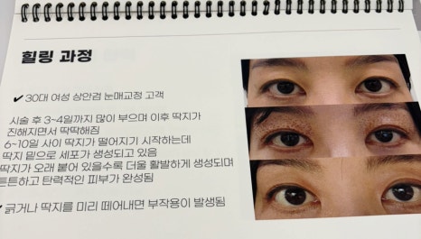 움뷰티 이미지