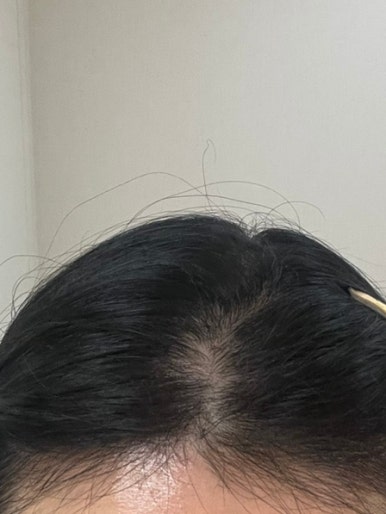 메디엑스 이미지