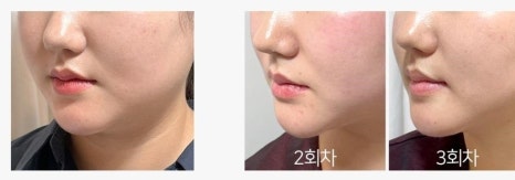 대박뷰티 이미지