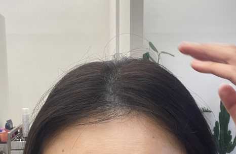 미에미헤어 이미지