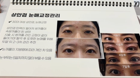 움뷰티 이미지