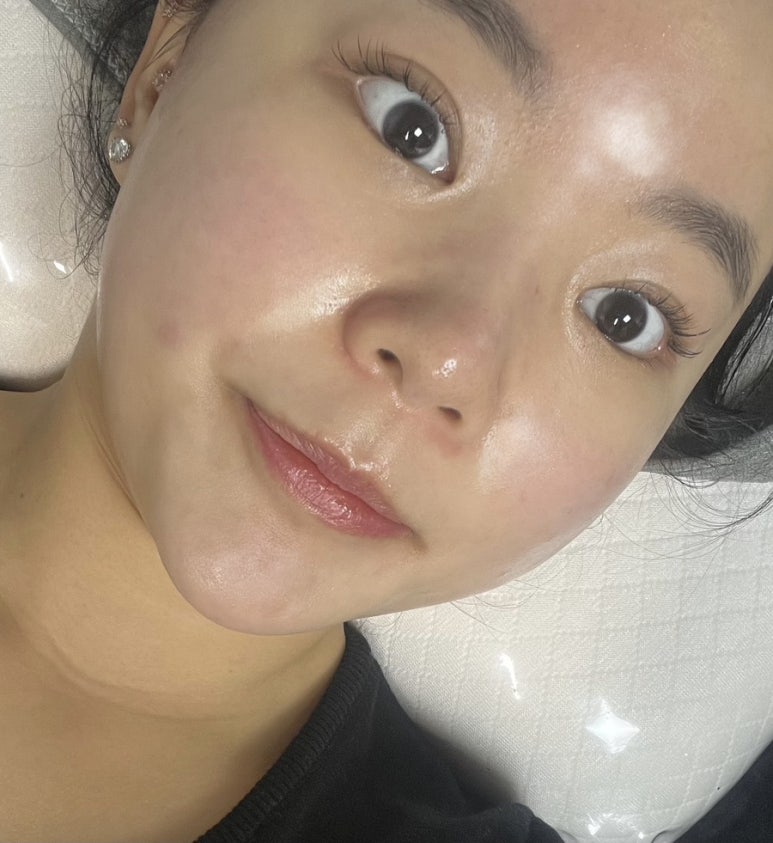 고차원피부관리 이미지