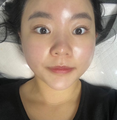 고차원피부관리 이미지