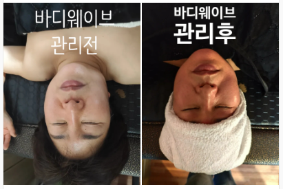 바디웨이브파동테라피 이미지