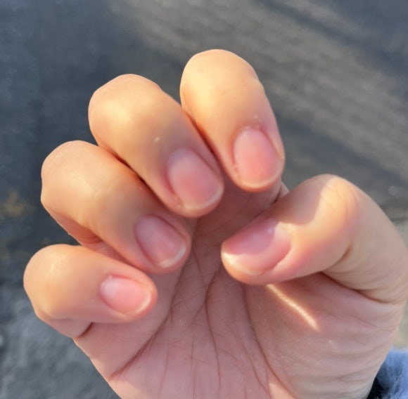 후딱오나 이미지