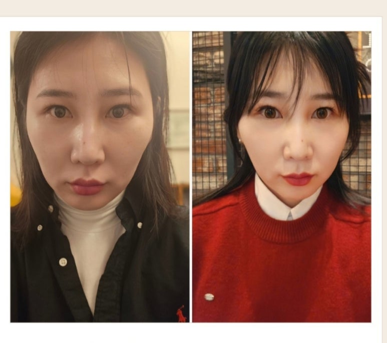 홍대신지윤피부관리 이미지