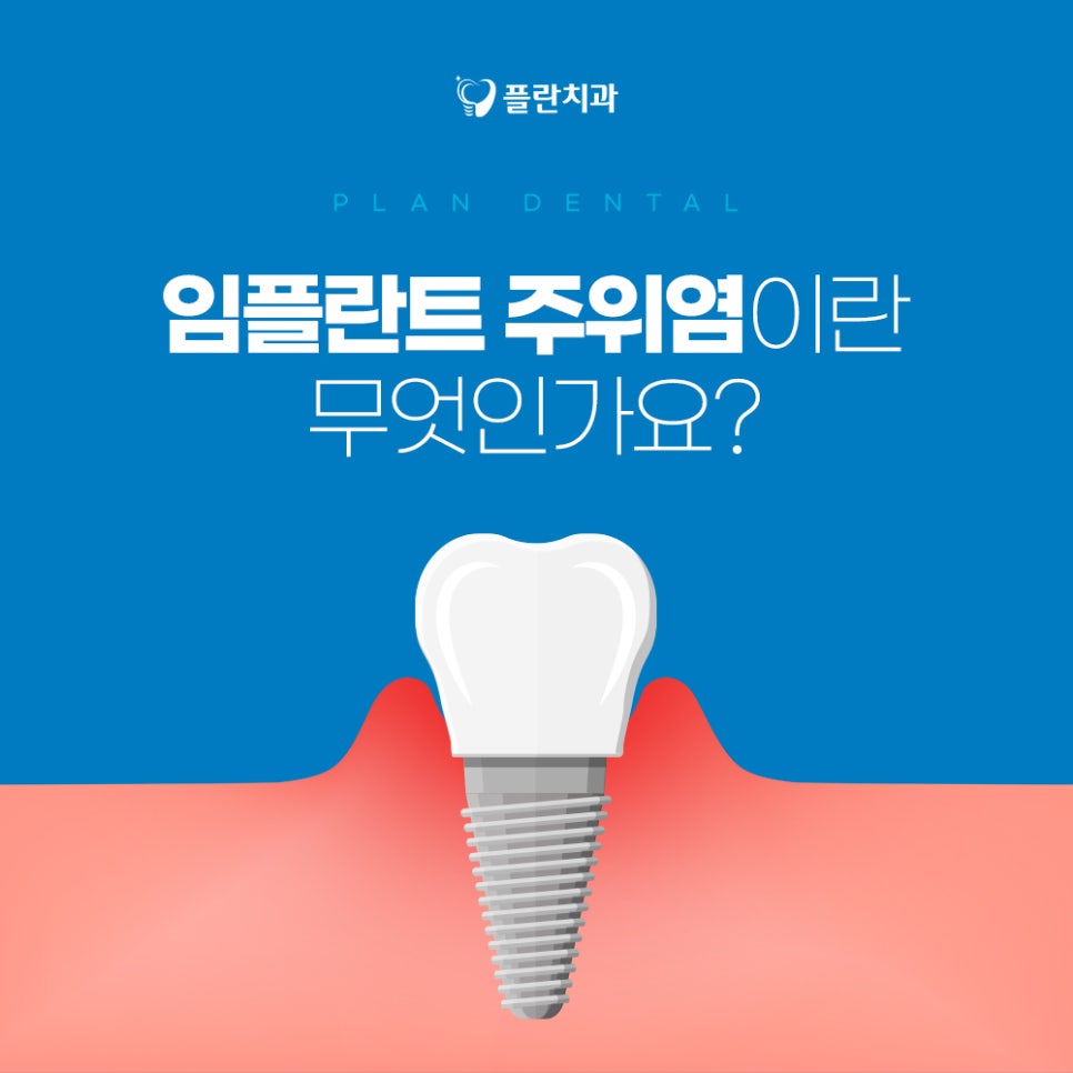 플란부평 이미지