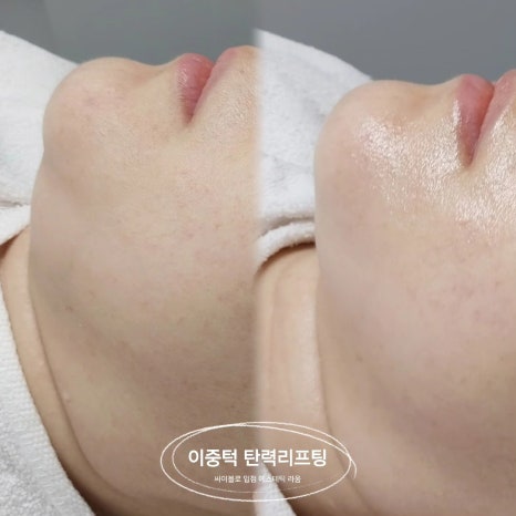 뷰티라움 이미지