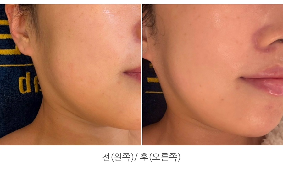 아레떼뷰티랩 이미지