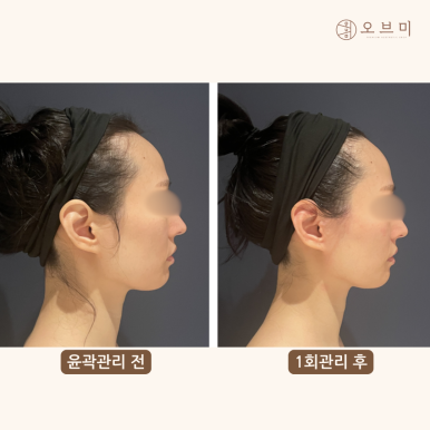 오브마곡 이미지