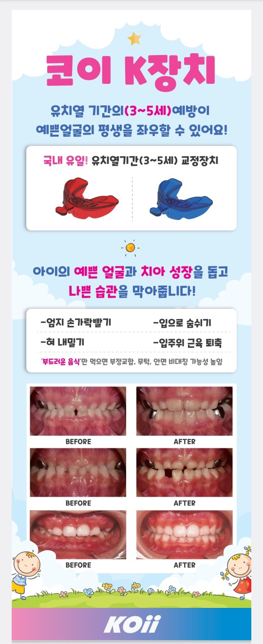 코이(koii) 이미지