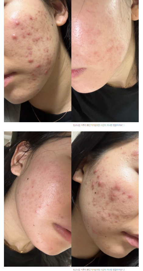 제이더블유메디 이미지