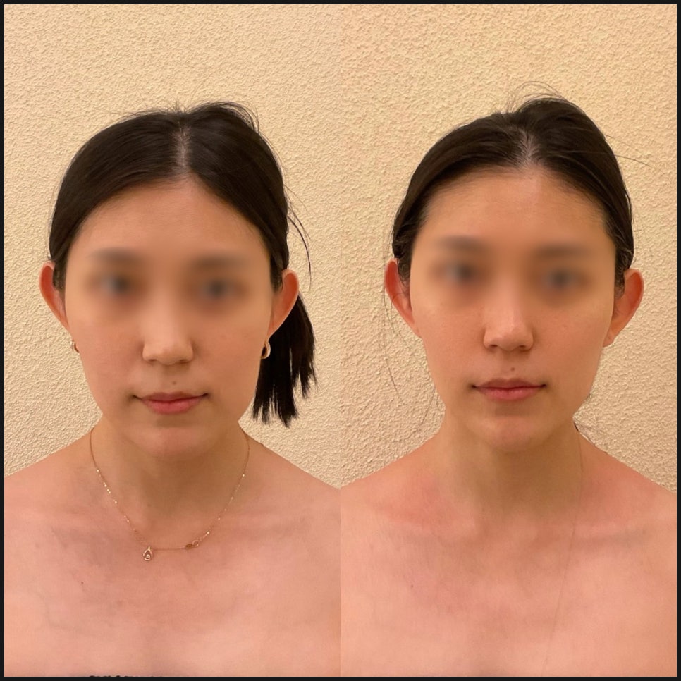 셀핏 이미지