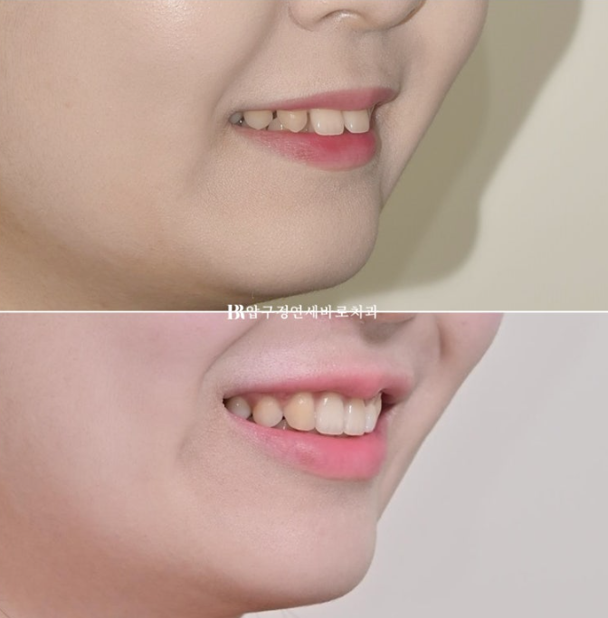 젤라 이미지