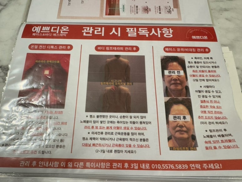 예쁘디온 이미지