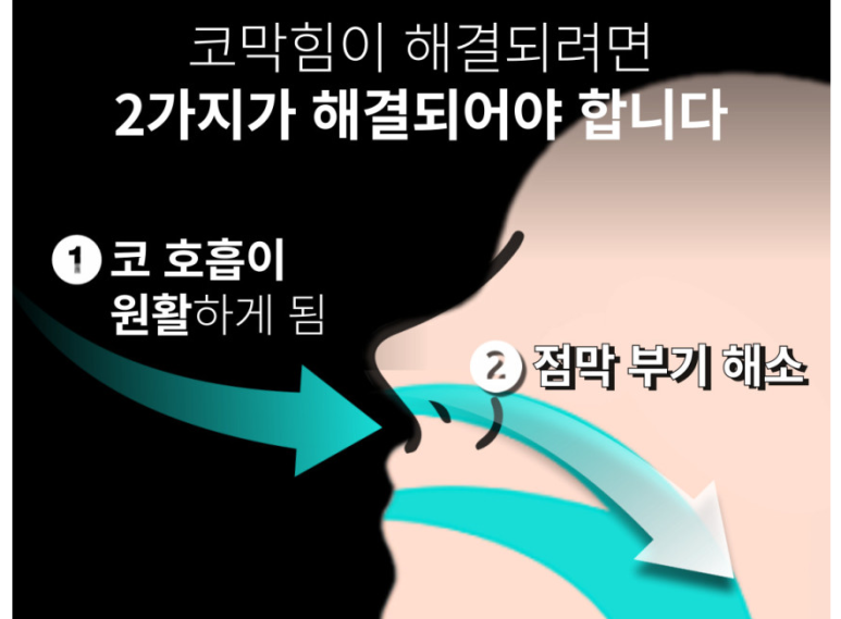 팩코 이미지