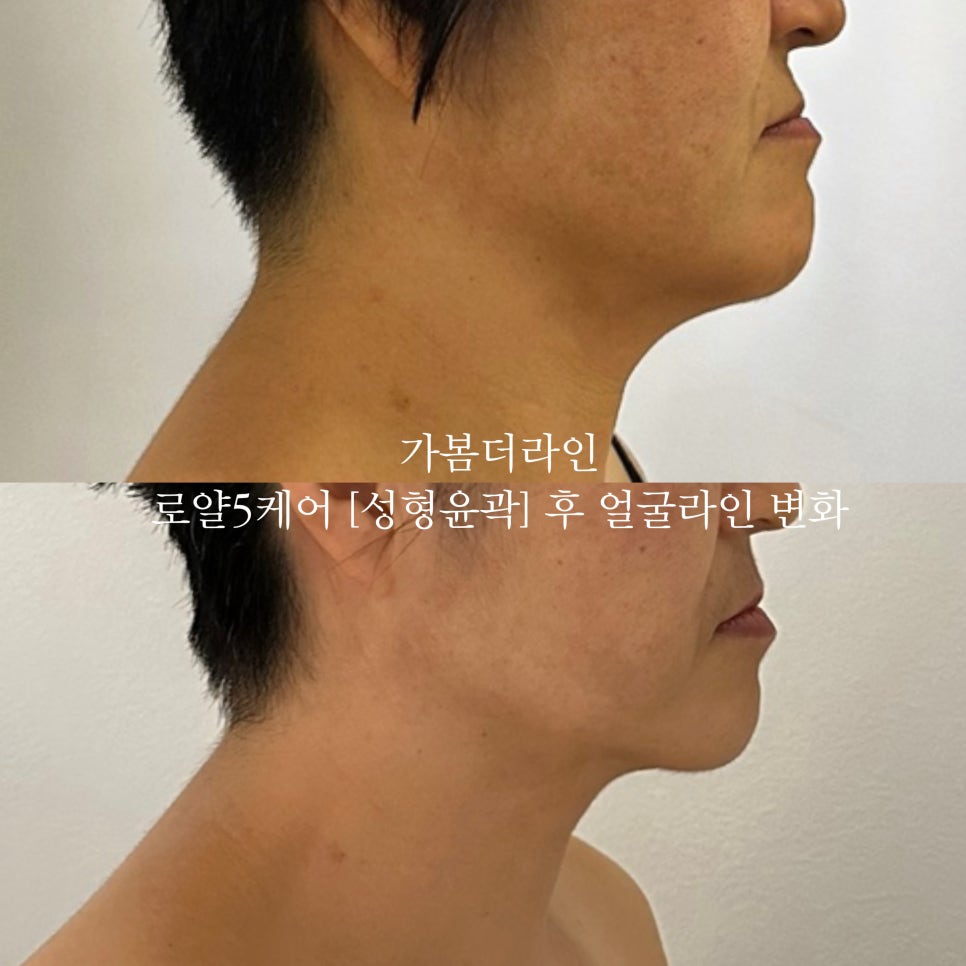 더라인 이미지
