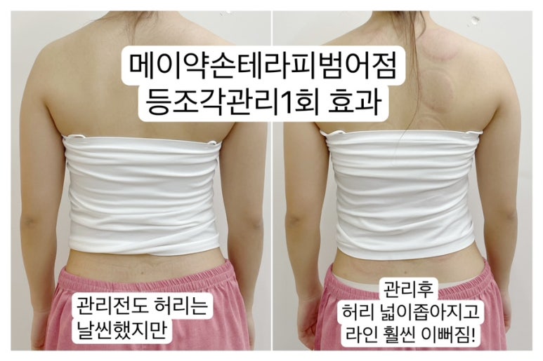 메이약손테라피 이미지
