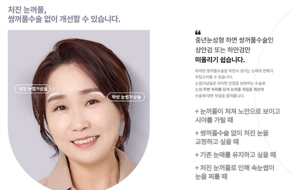 훌륭성형외과 이미지